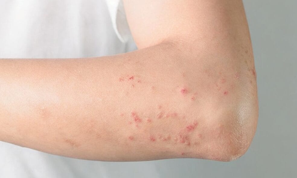 skin problems